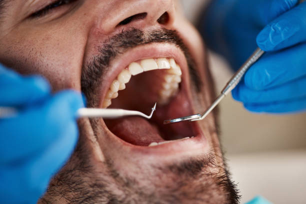 Best Emergency Treatment for Dental Infections or Abscesses in Kissee Mills, MO